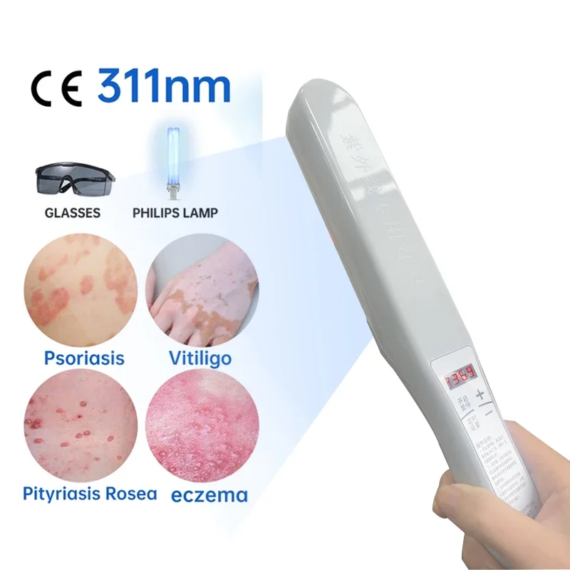 vitiligo phototherapy device excimer psoriasis psoriasis household uvb311 ultraviolet lamp