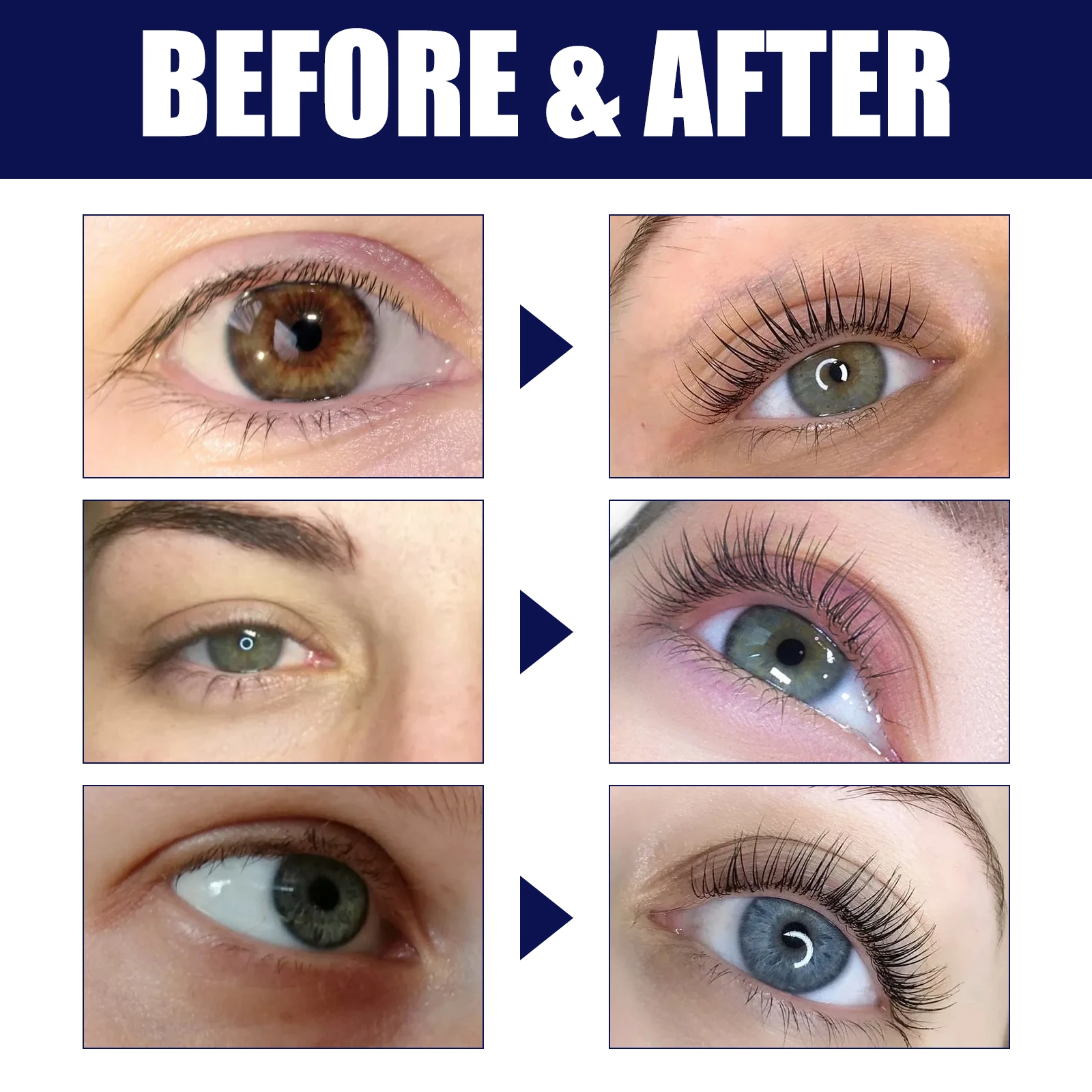 Fast Growth Treatment Eyelash Serum ยาว Lash แต่งหน้าที่มีประสิทธิภาพขนตาหนาธรรมชาติ Curling Lash Lifting Care ใหม่