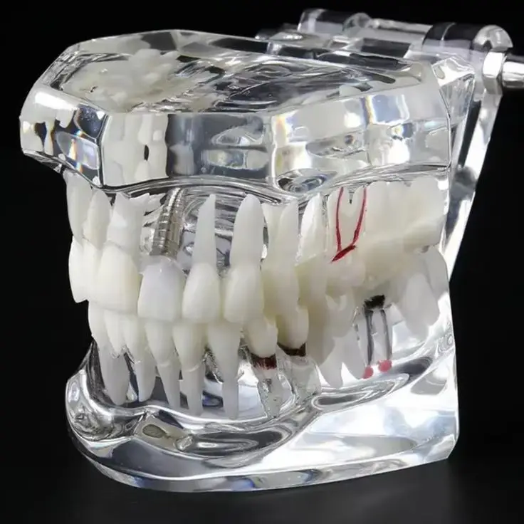 

Зубная модель для обучения и изучения имплантации, реставрации, мостовидных протезов, стоматологических процедур, а также для изучения заболеваний в медицинских науках.