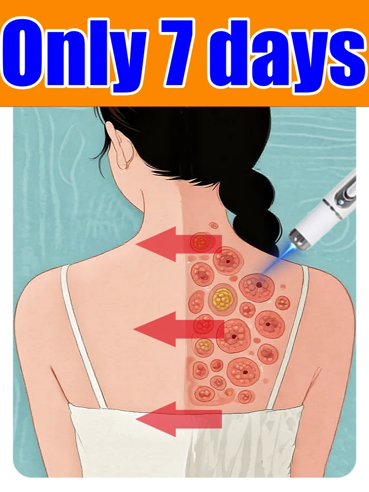 

Daily wart care technology device, easy to operate, long battery life