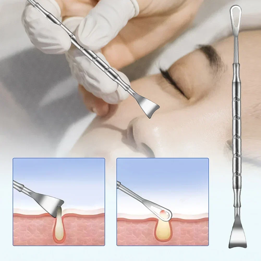 مزيل الرؤوس السوداء بثرة بوبر أداة الأنف الوجه العيب النازع حب الشباب إبرة إزالة العلاج Whitehead ظهرت