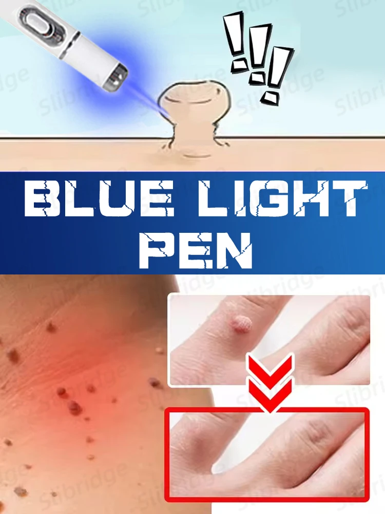 

Pʀᴏғᴇssɪᴏɴᴀʟ sᴏʟᴜᴛɪᴏɴ ᴛᴏ sᴋɪɴ ᴘʀᴏʙʟᴇᴍs