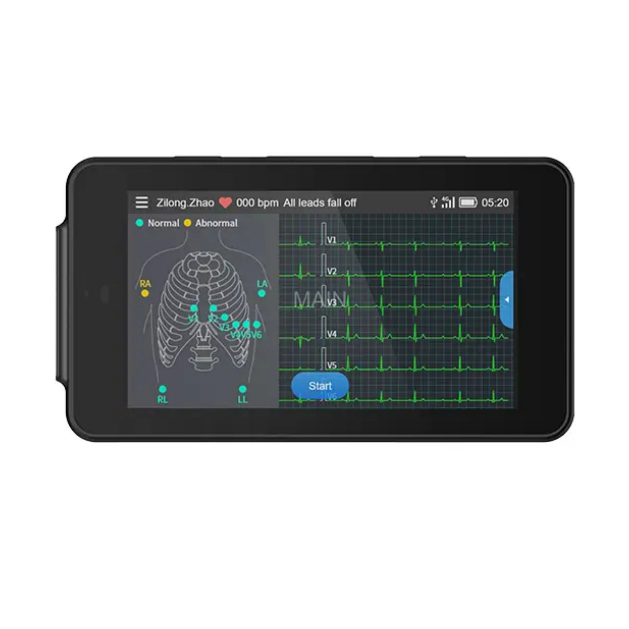 CE Certified 12-Channel Dynamic ECG/EKG Systems Recorder Excellent Quality Veterinary Instrument Holter