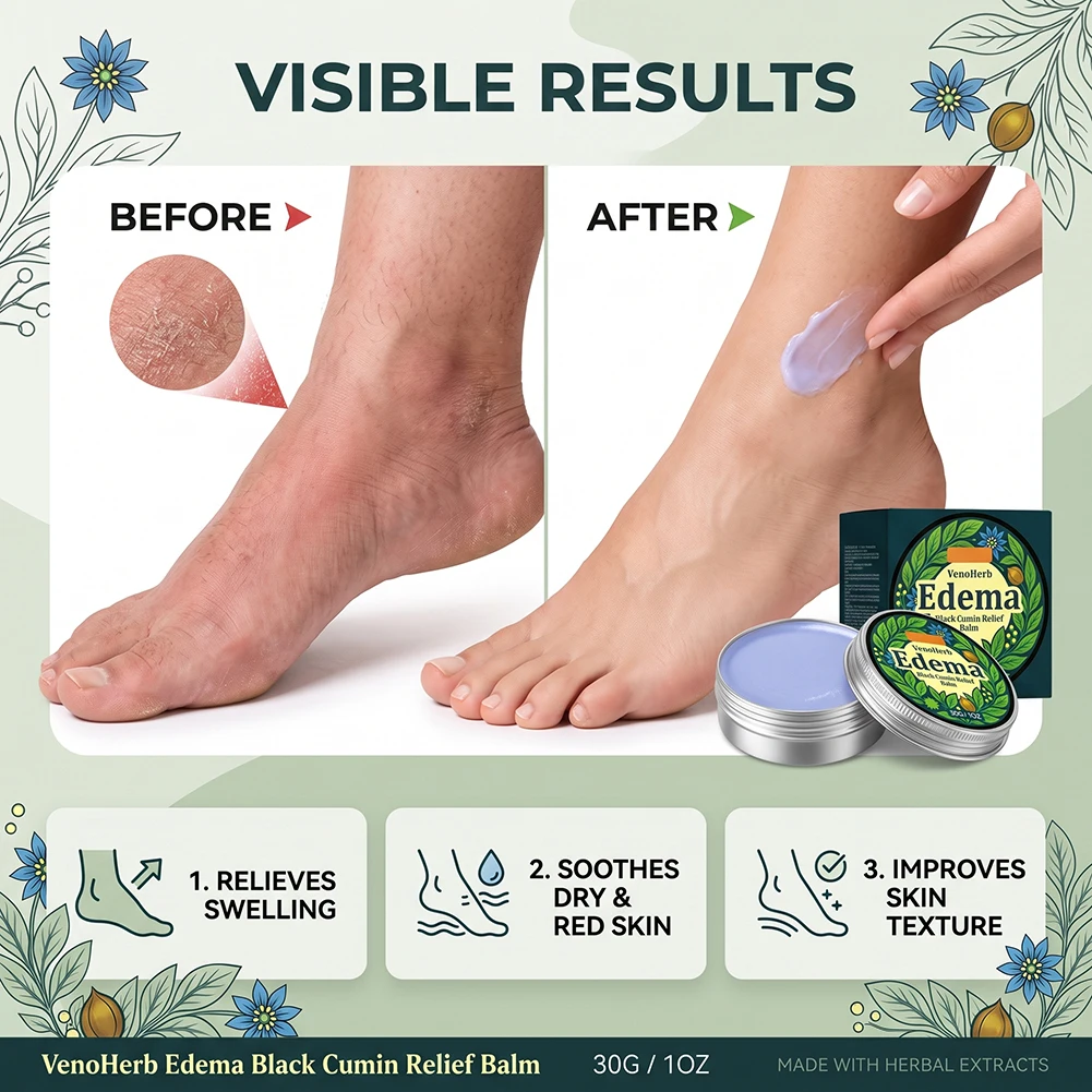 Edema Black Cumin Relief Balm Muscle Relief Relaxation Massage Balm Improves Vein Varicose Body Balm For Extremely Dry Skin