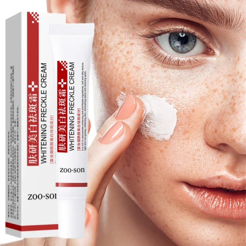 Gesicht Melasma Creme aufhellende dunkle Haut Emulsion aufhellende Melanin aufhellen Creme für stumpfe Haut Frauen feuchtigkeit spendendes Produkt neu