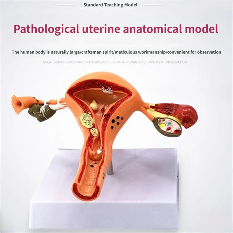 

Medical Science Normal/Pathological Uterus Ovary Anatomical Model Anatomy Cross Section Medical teaching supplies