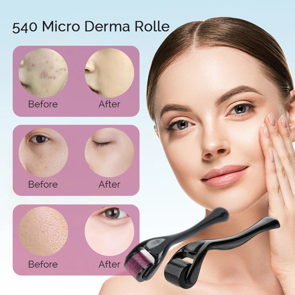 540 針ダーマローラー育毛ひげフェイシャルスキンケアボディ MTS マイクロニードルローラーチタンマイクロフェイスロールツール