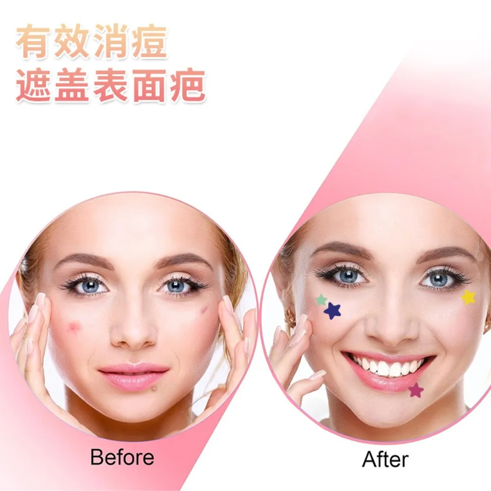 40pcs Colorful PE Pimple Patches Cute Star Shaped Pimple Cover Sticker Skin Care Sticker Concealer Face Spot Beauty Makeup Tool - Image 2