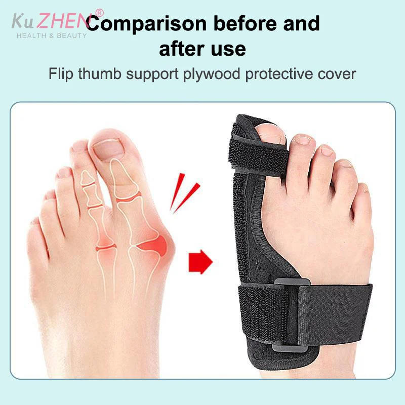 1 pz cinghia fissa borsite correttore regolabile alluce valgo ortesi correttore traspirante borsite per la correzione dell'alluce valgo