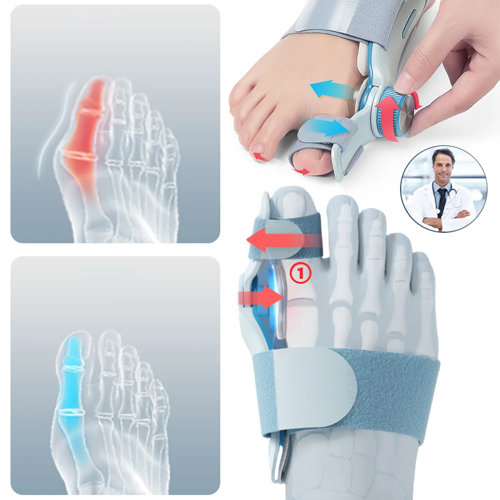 Corrector de juanete para el cuidado de los pies, férula ortopédica para juanete, alisador de corrección de perilla Hallux Valgus para el cuidado de los pies, 1/2 Uds.