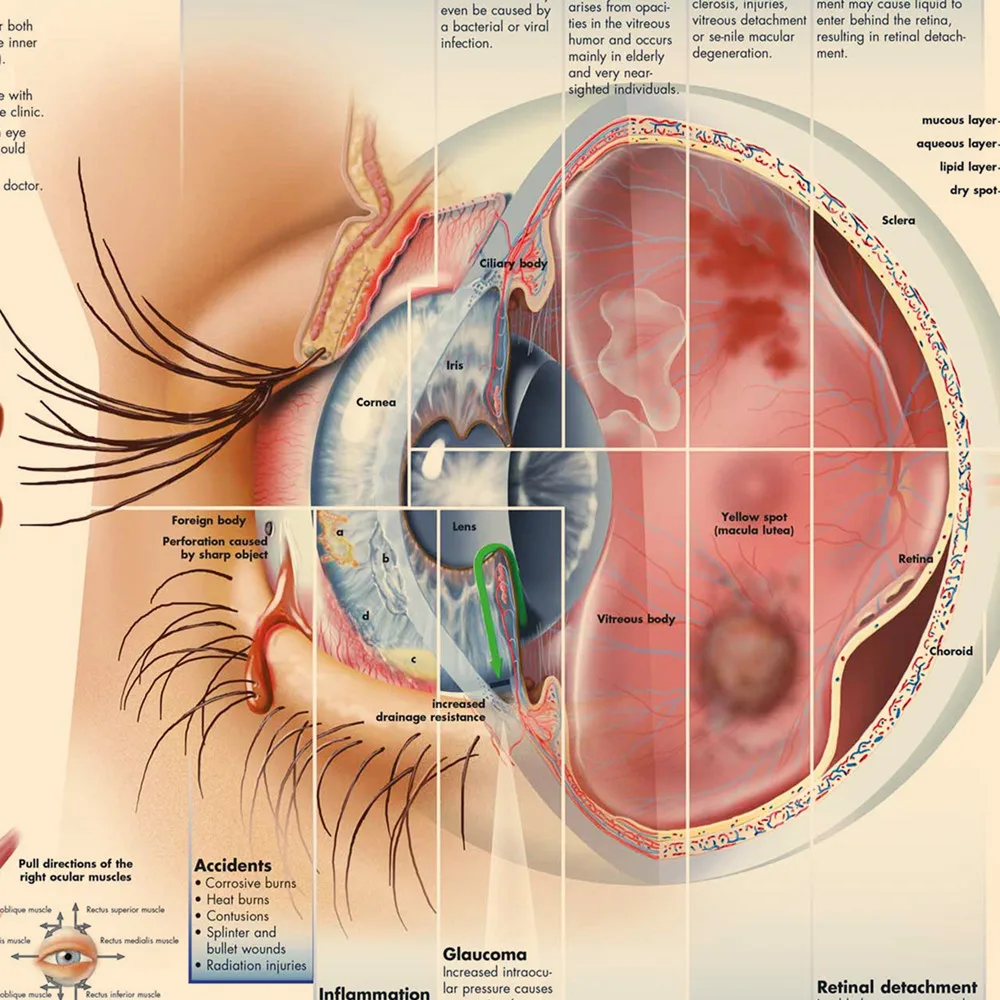 Diseases of the Eye Vintage Medical Posters and Prints Human Anatomy Wall Art Painting Wall Chart Hospital Clinic Home Decor