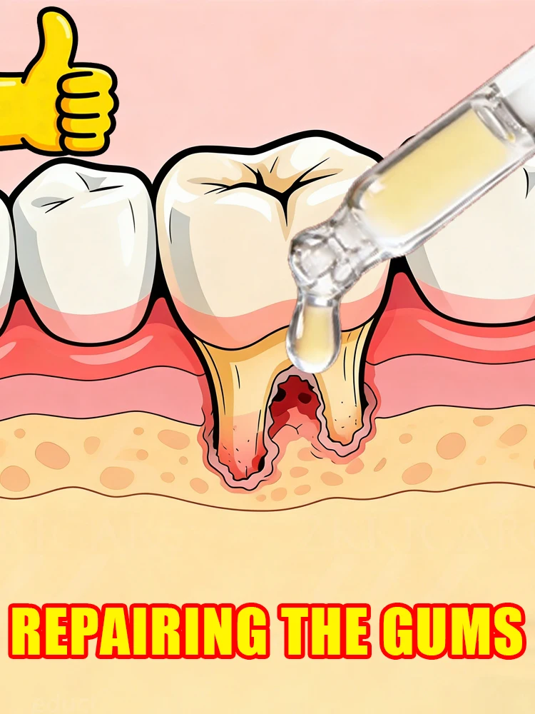 

Регенерирующие десны в течение 7 дней, прикрывающие зубы