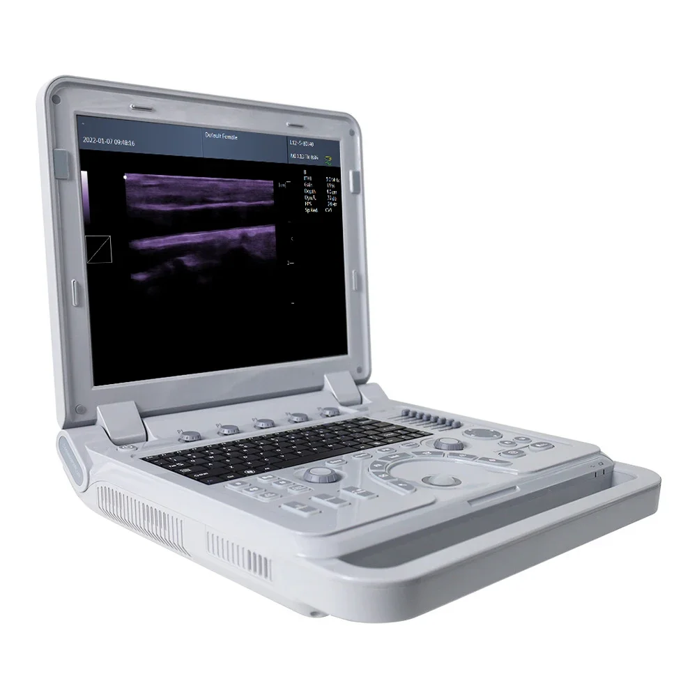 CONTEC CMS600P2 PLUS  portable ultrasound machine pseudo color doppler medical ultrasound Pulse Spectral Doppler instruments