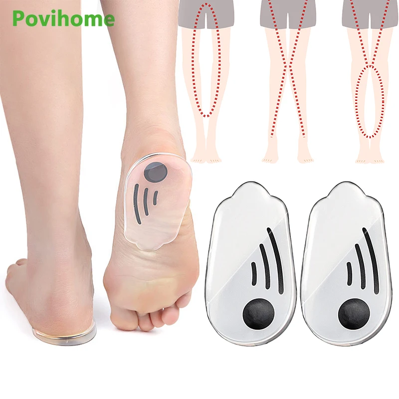 3Pairs O/X Leg Shape Posture Corrector Silicone Heel Magnetic Pads Bowed Knee Valgum Straightening Correction Beauty Health