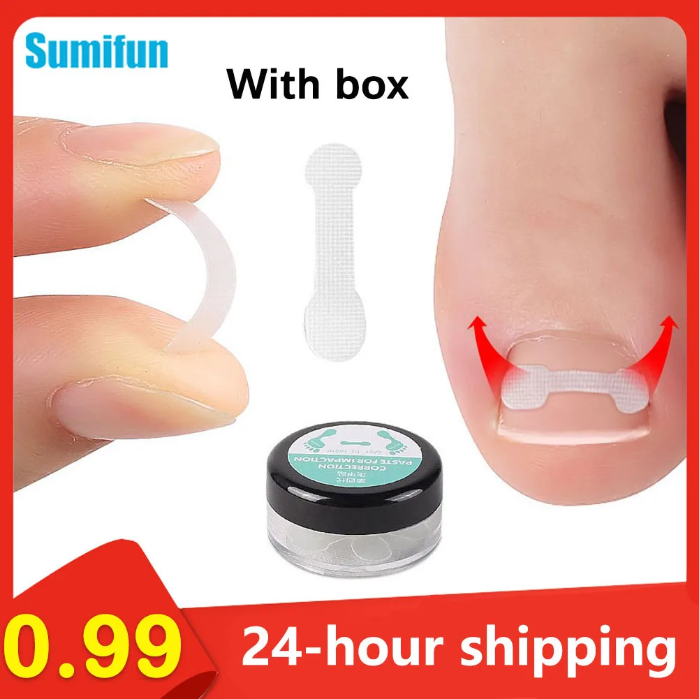 

10/30/50Pcs Ingrown Toenail Corrector Patches Nail Correction Care Stickers Paronychia Treatment Recover Corrector Pedicure Tool