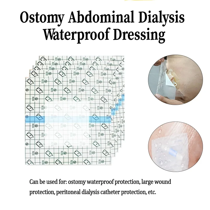 10 Peças de Adesivos Transparentes Impermeáveis para Ostomia, Diálise Abdominal e Feridas, com Membrana de PU, Tamanho Grande