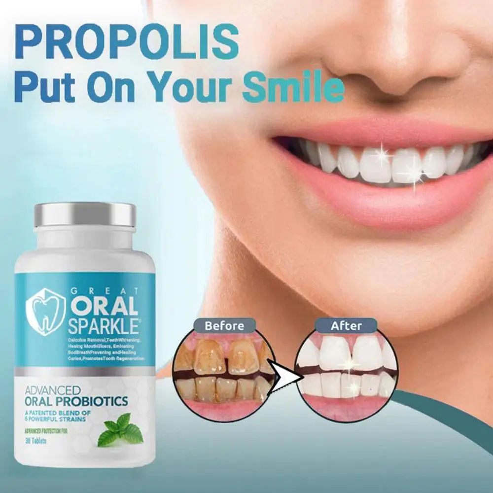 Probióticos sólidos creme dental comprimidos, clareamento dos dentes, carvão vegetal, remove manchas de fumaça, mau hálito, bochechos frescos, Oral Care