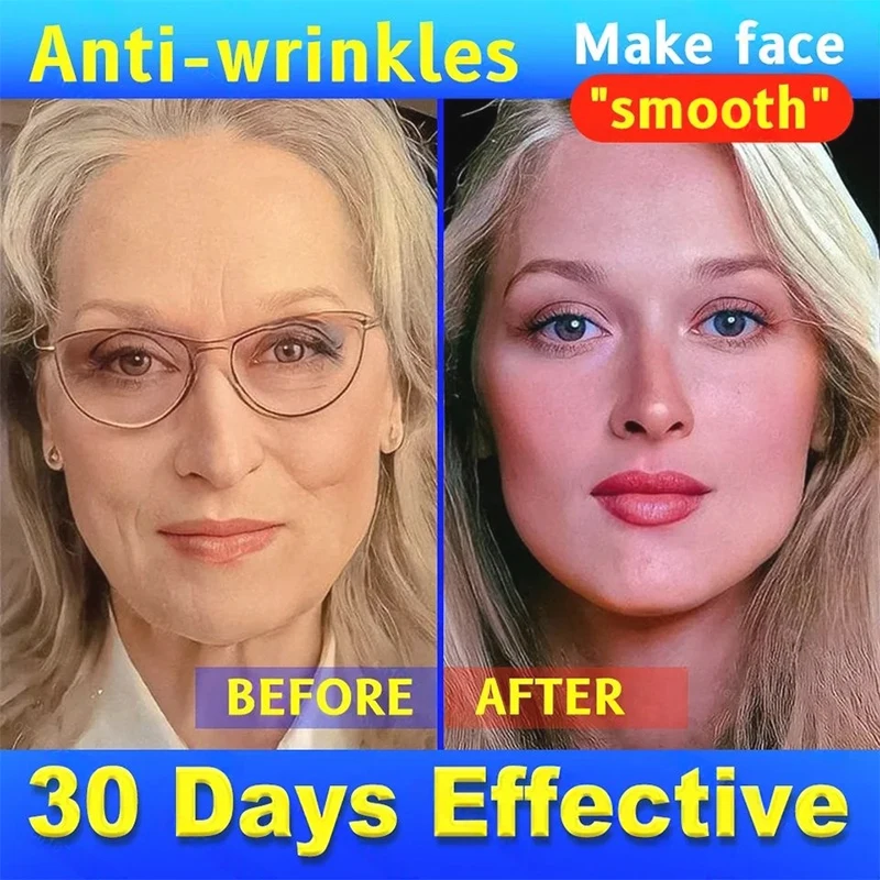 

beauty anti-wrinkle oxys cream wrinkles remover bubbles skincare coreanos whitening cream skin care Anti-wrinkle facia ankorean