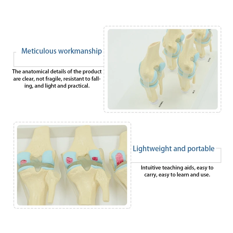 Risorse didattiche anatomiche dell'anatomia dello scheletro del modello dell'articolazione del ginocchio umano