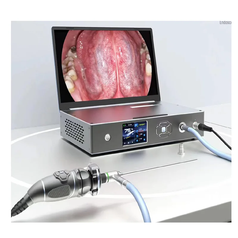 15inch all in one laptop 1080p endoscope camera with light source