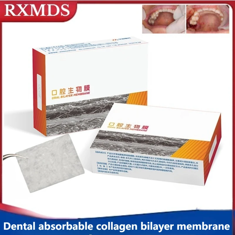 Nueva Membrana de Colágeno Resorbible de Doble Capa para Implantes Dentales, Reparación de Defectos Óseos Alveolares, Biopelícula Oral para Uso en GBR de Implantes Dentales