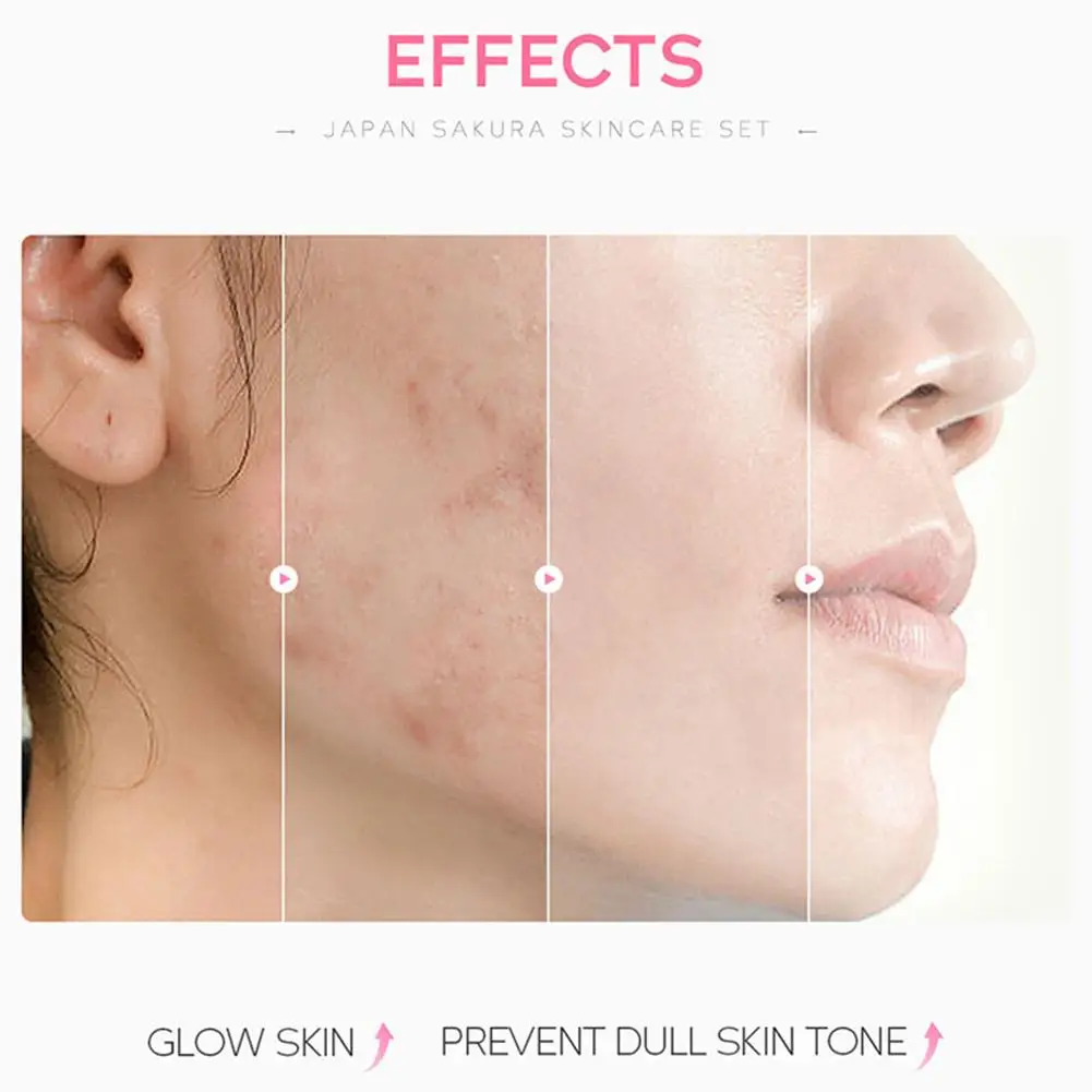 Ensemble de soins de la peau Blossom, crème pour les yeux au collagène, sérum nettoyant pour le visage, toner, crème pour le visage, maquillage de beauté, coffret cadeau, 5 pièces