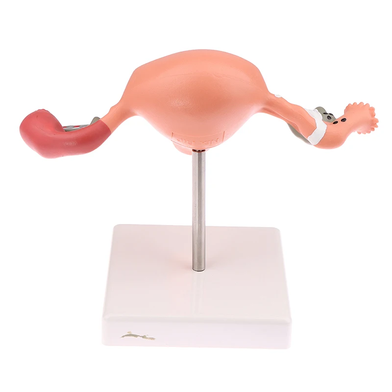 1Pcs Medical Props Model Pathological Uterus Ovary Anatomical Model Anatomy Cross Section Study Tool