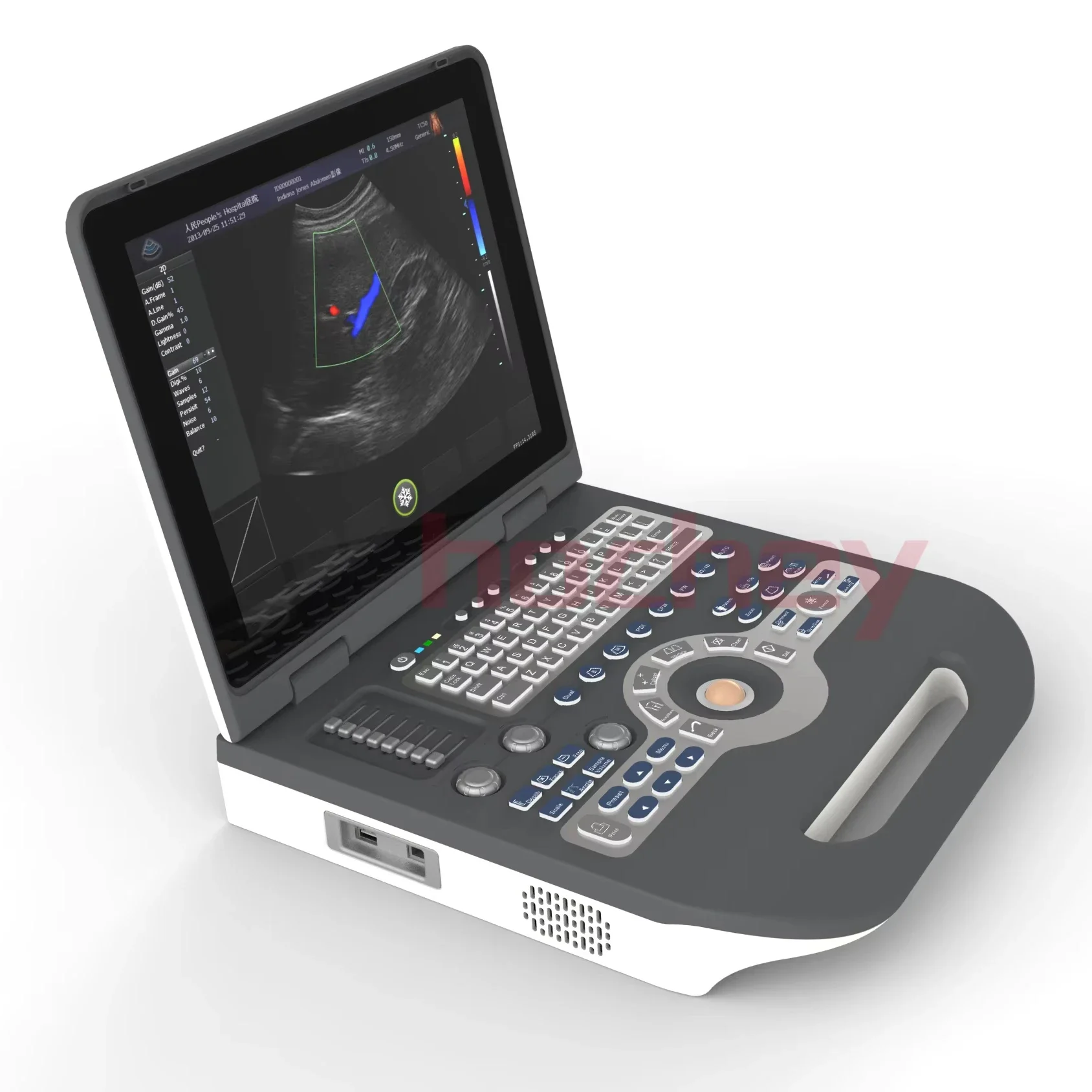 MT MEDICAL Portable Laptop 2D 3D 4D Color Doppler Ultrasound Scanner Machine for Veterinary and Human