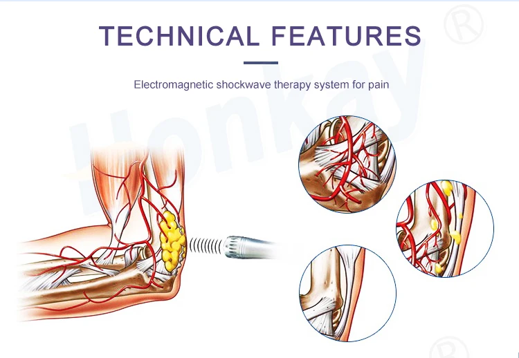 Machine de thérapie Ed Shockwave avec écran tactile, ondes de choc, graisse du ventre, oto Treatment Instituts, 8 pouces