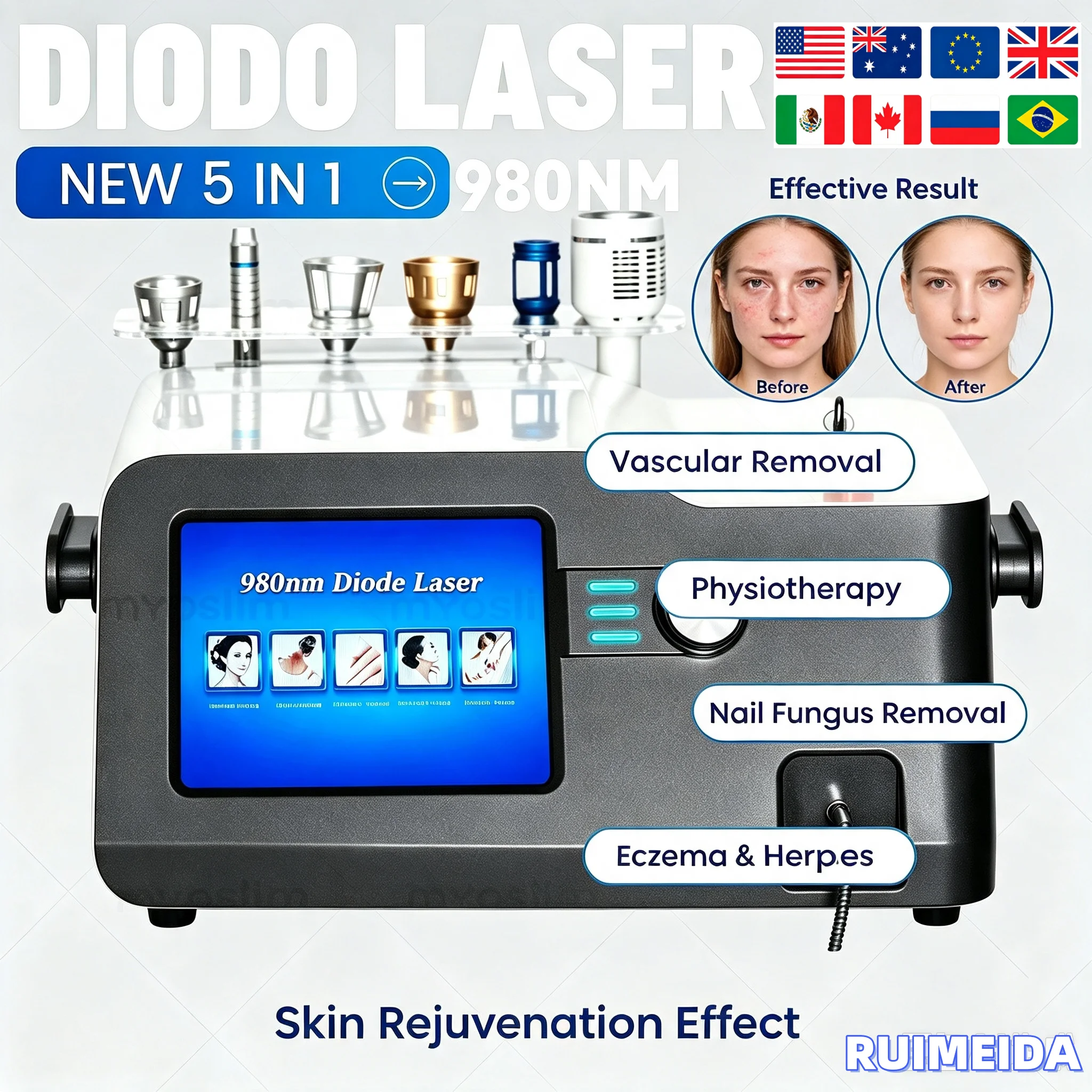 980nm Diode Lase Blood Vessels Removal 5 in 1 980 Diode Lase Vascular Removal Machine Nail Fungus Remove Eczema Herpes 30W