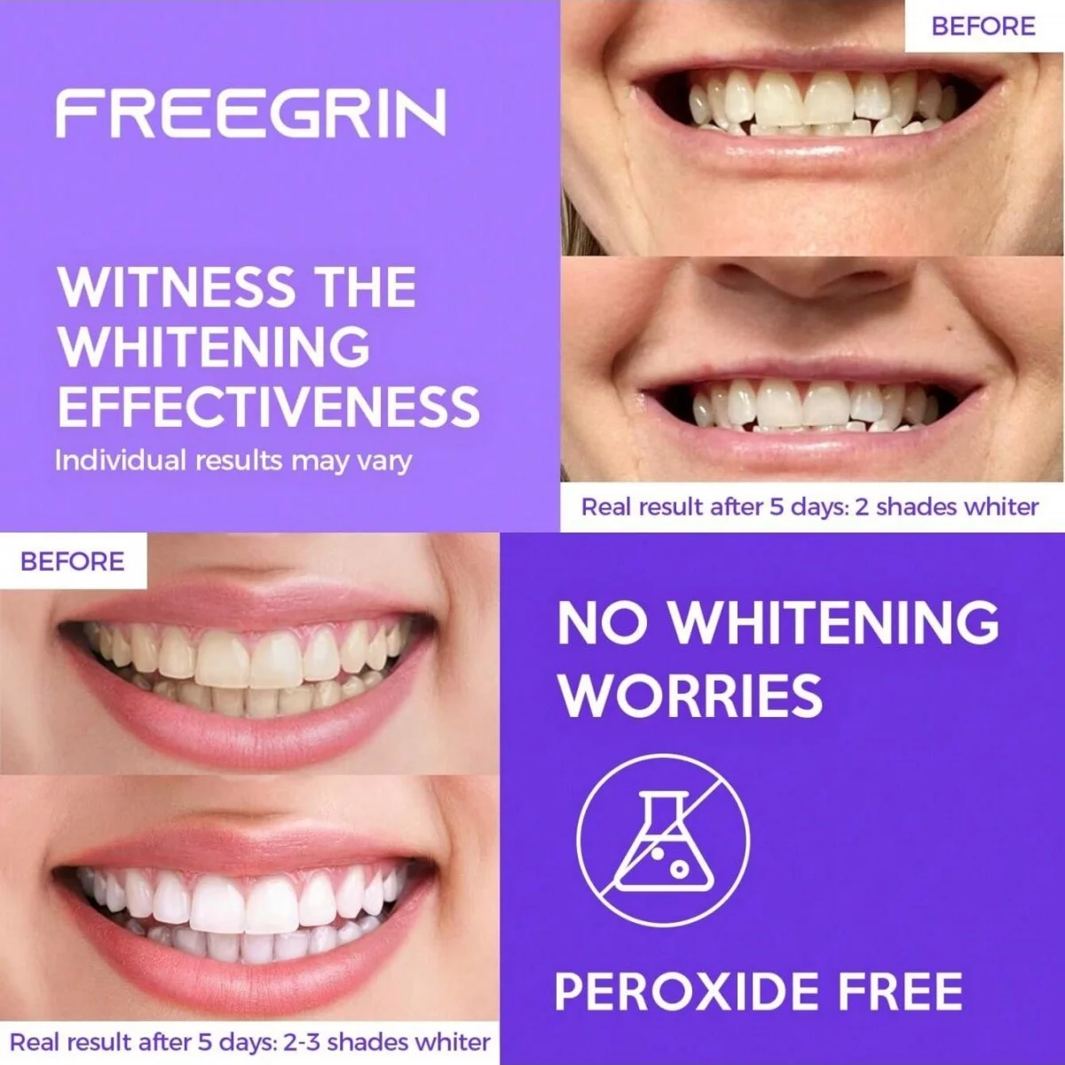 Deluxe Whitening Teeth Stickers 7/14/21 Pairs Gel Whitening Strips Stain Removal Tools Teeth Mint-flavored Refreshing Breath
