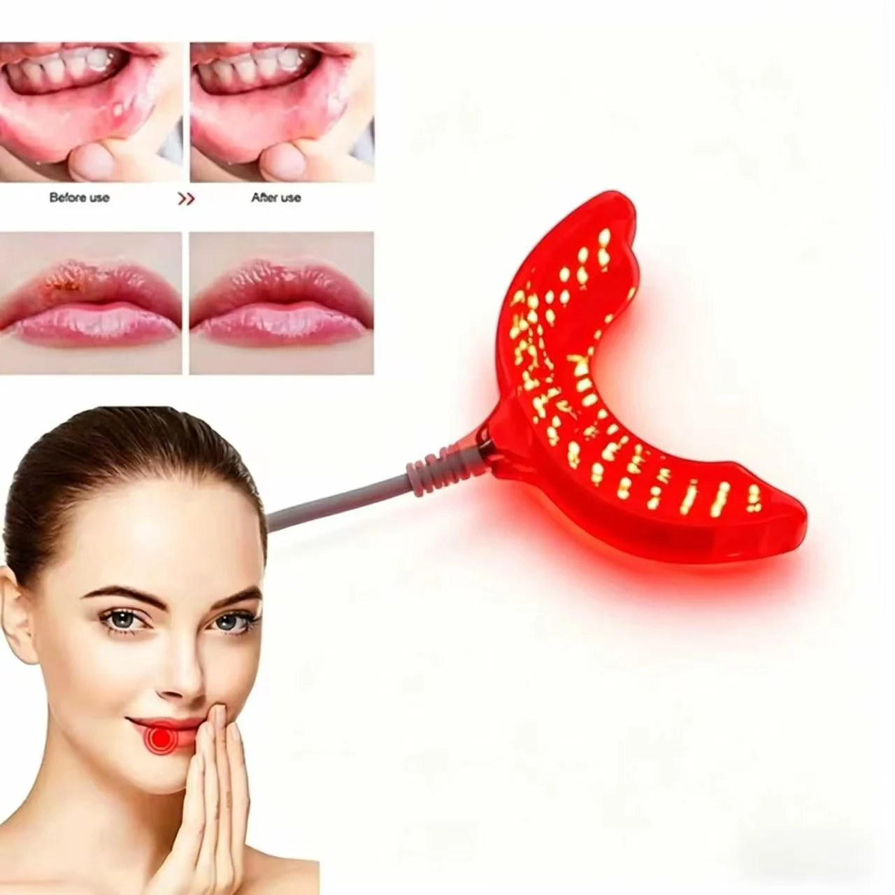 

Professional Oral Therapy Device Red Light Treatment for Immediate Tooth Pain Gum Sensitivity Relief