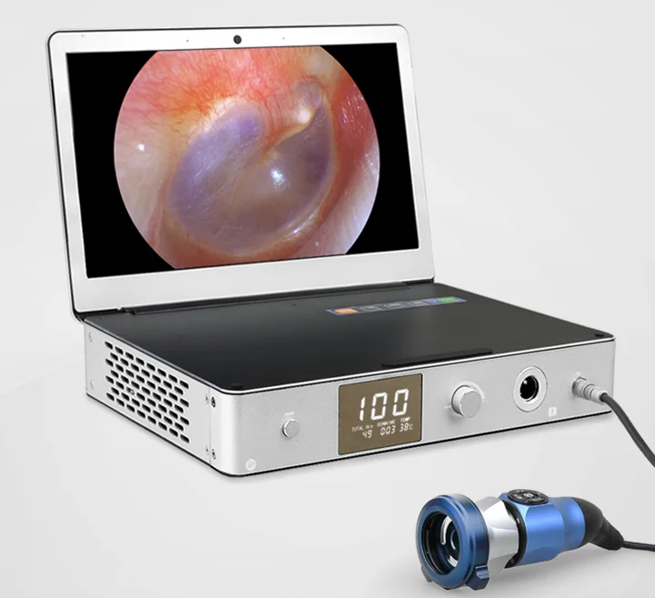 

Portable medical hd endoscope system, check all-in-one otolaryngology endoscopic surgeryWith a 11.6 -inch monitor