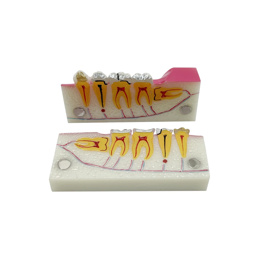 Dental Model Teeth Teaching Anatomy Model Molar Cross Section Of Lower Right Posterior Teeth Decomposition Model For Education