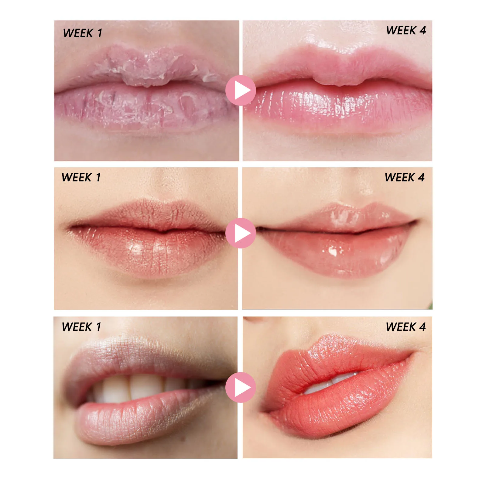 Pfirsich Lippen peeling Creme Set verblassen Lippen falten entfernen abgestorbene Haut verhindern trockene und rissige Lippen nähren und befeuchten Lippen pflege produkte