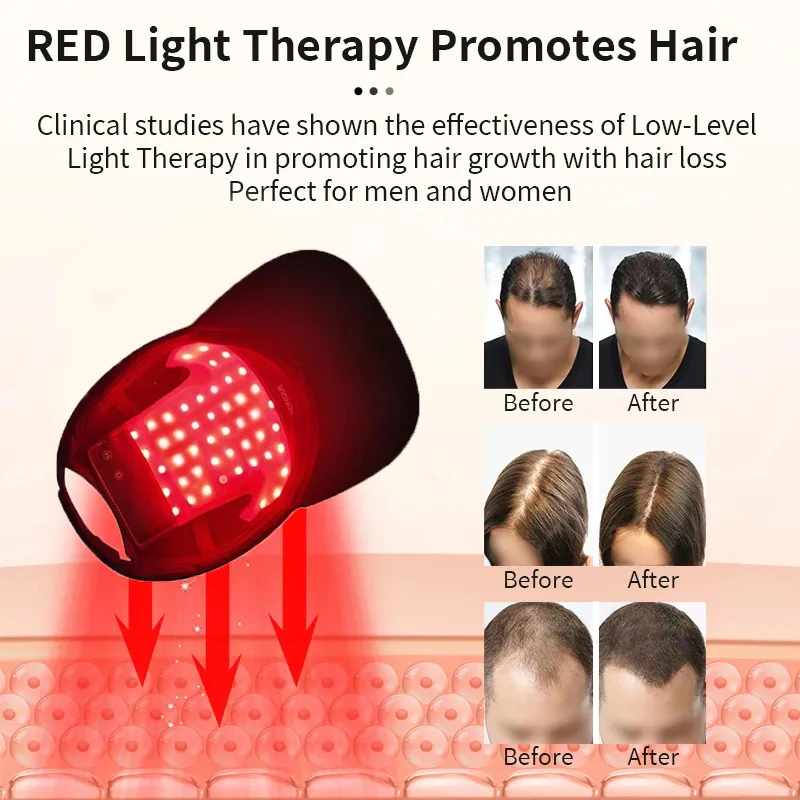 

LED Red Light Therapy Devices Hair Growth Cap Anti Hair Loss Anxiety Stress Relief Head Pain Hat Scalp Relax Massager cap