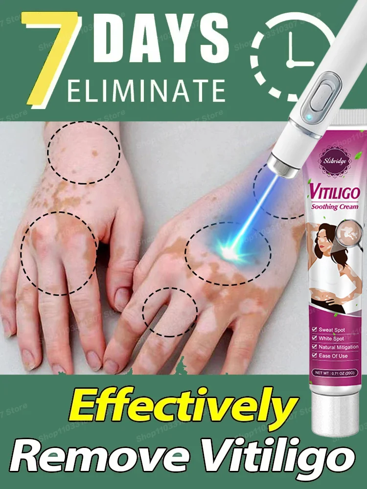 

Quickly Improve Vitiligo Laser