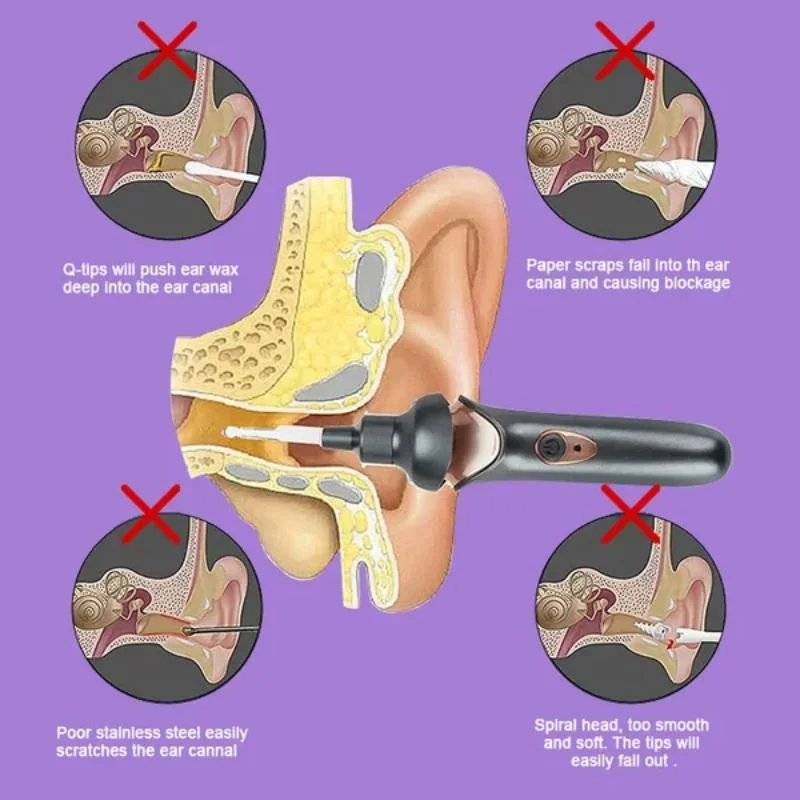 Electric Luminous Ear Pick Rechargeable Electric Ear Suction Device Painless Ear Cleaner Ear Wax Removal with Light Ear Care