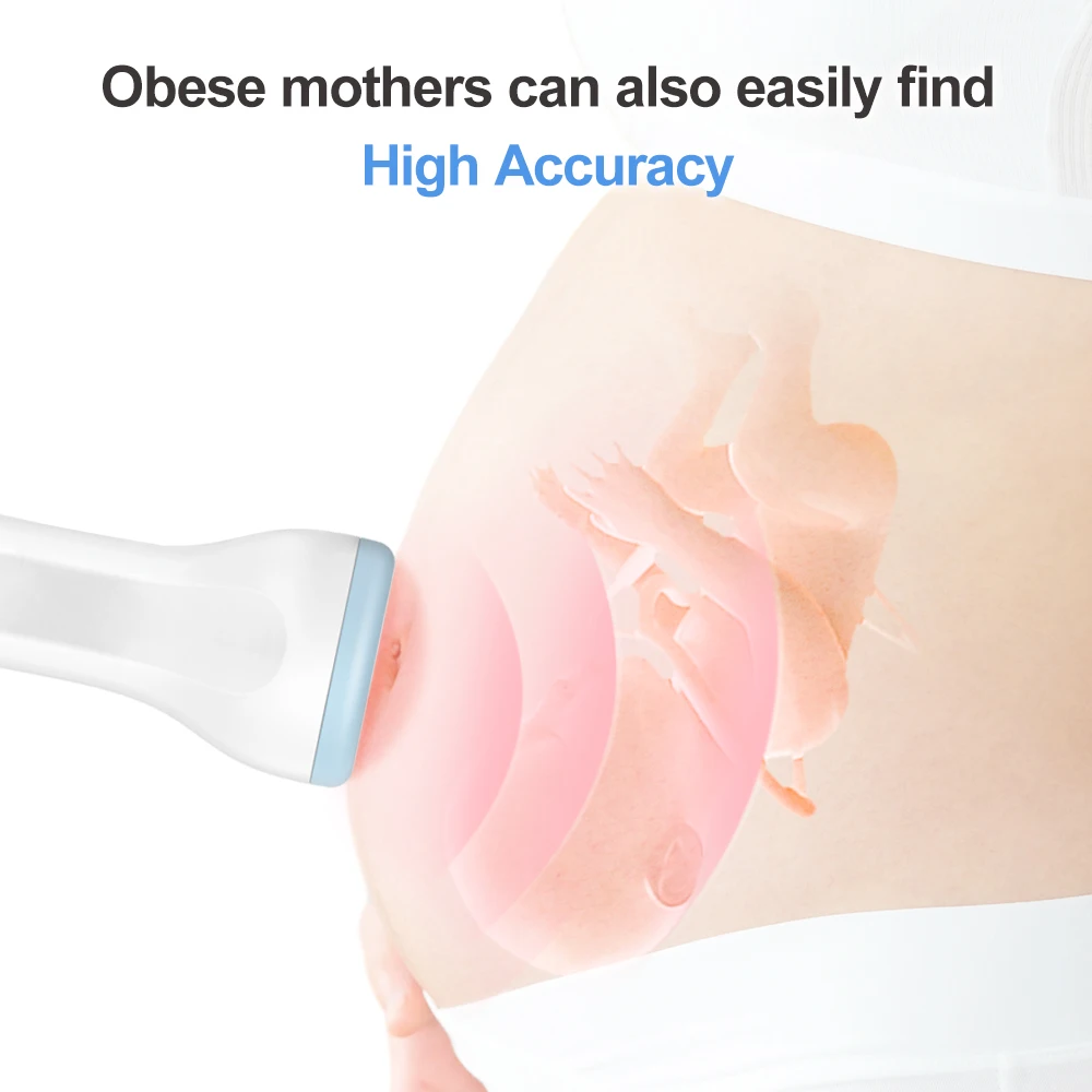 Cofoe Fetal Doppler Heartbeat Detector Baby for heart beat monitor LCD backlight Pulse Meter No Radiation Stethoscope