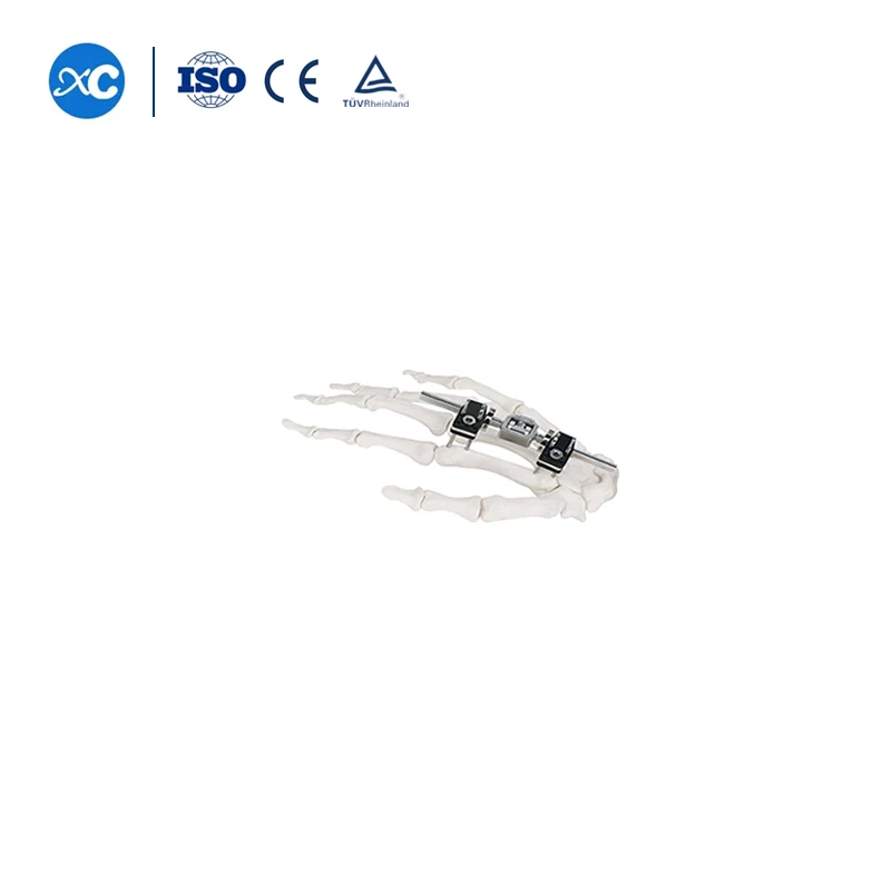 Surgical Fracture Universal Compression Extension Type Mini Fracture Fixation Orthopaedic External Fixators