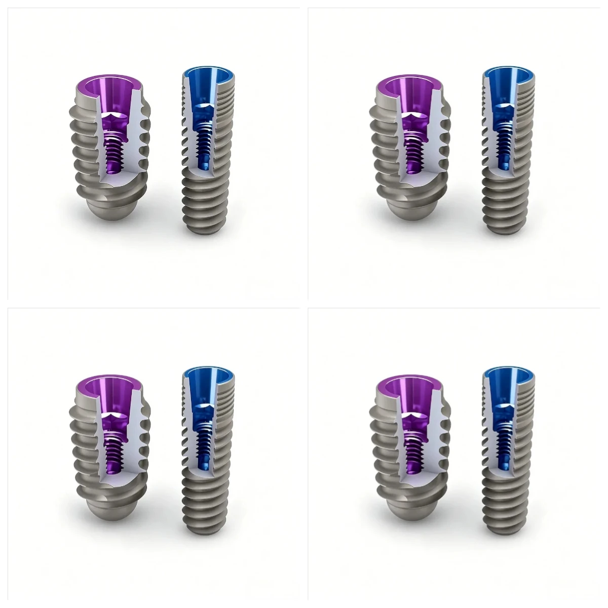 Premium Dental Implant Accessories Implant Screw Implant Analog Full Sizes Restoration Supplies