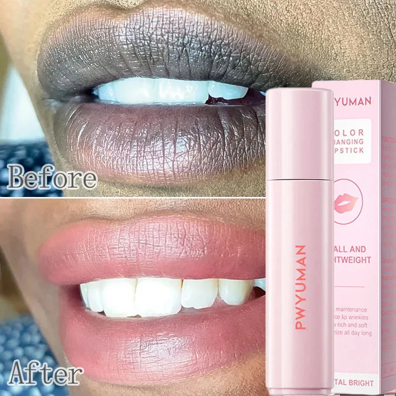 Lips Pink Cream Fresh Bleaching Treatment Remove Dark Smoke Lips Lip Balm Whitening Moisturizing Serum Dilute Melanin Lip Care