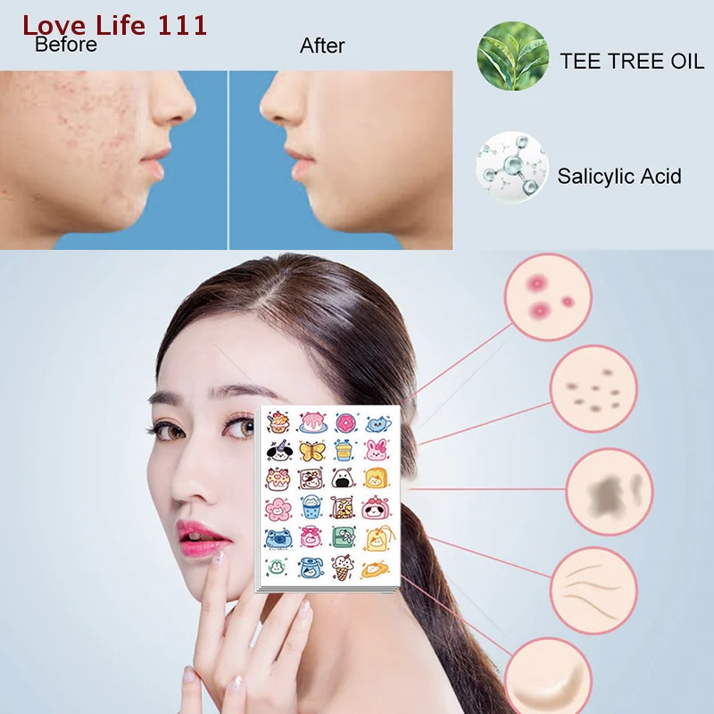 

New 96pcs Acne Patches Cartoon Cat Shaped Acne Treatment Sticker Invisible Acne Cover Removal Pimple Patch Skin Care