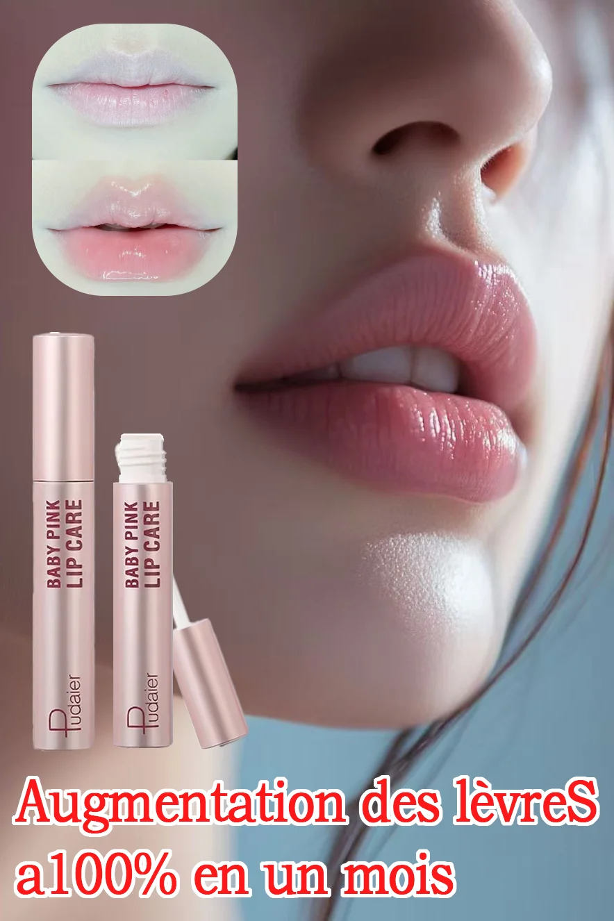 

100% lip augmentation in one month