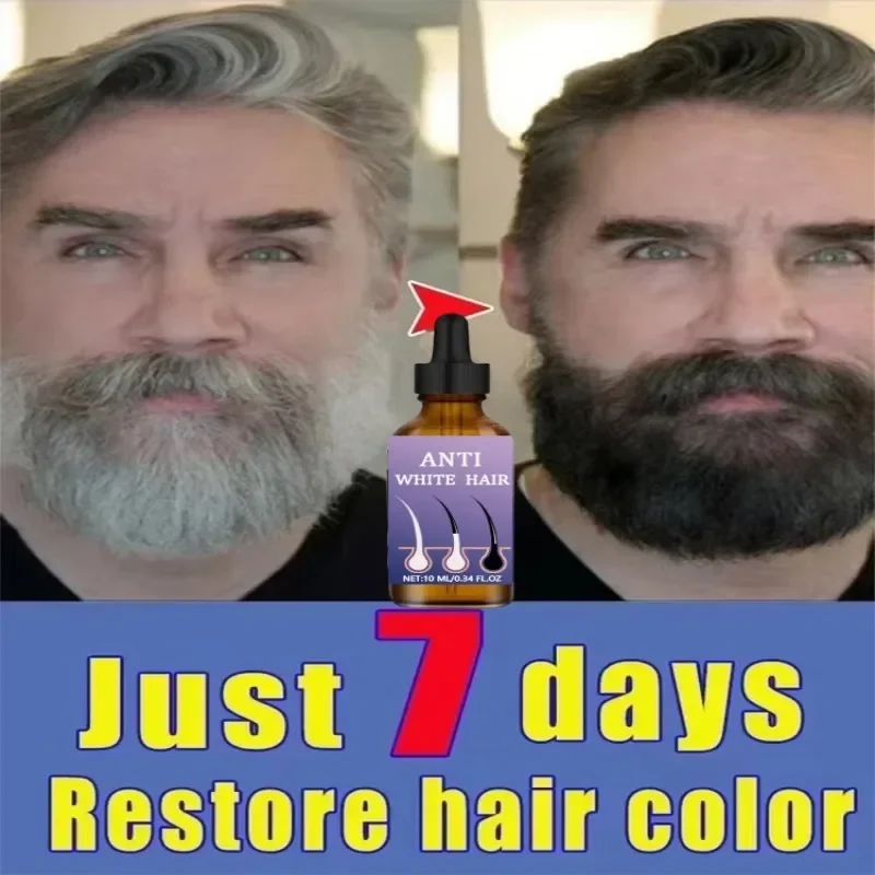 Gray White Hair Treatment Serum Liquid White To Black Natural Color Repair turns white into black, and prevents gray Men Women