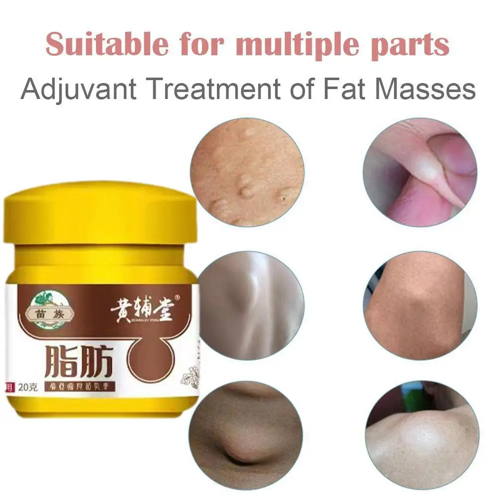 20g Lipoma Remover Treatment Cream Fat Mass Herbal Medicine Plaster Lumps Fibroma Multiple Lipomas Cellulite Body Health Care