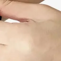 1 قطعة حزام دعامة المرفق للتنس دعم لالتهاب الأوتار لاعبي الغولف الكوع الساعد العصابات وسادة-تخفيف آلام الذراع