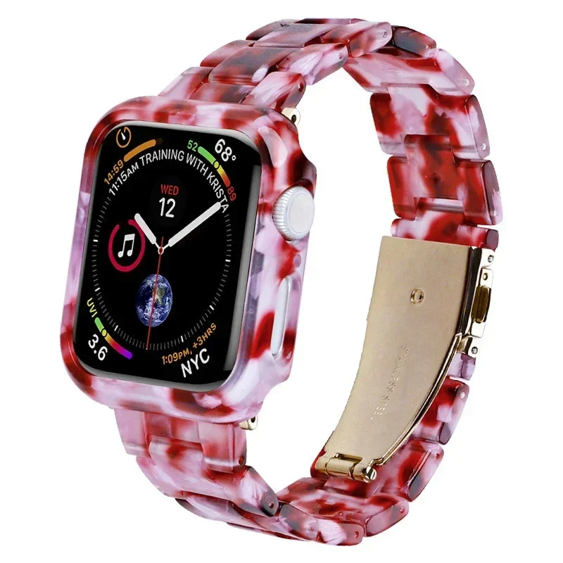 Resin Case+Strap for Apple Watch Series 9 41mm 45mm Band 38 40mm Cover Woman Bracelet for iWatch 8 7 6 SE 5 4 42 mm 44mm Correa