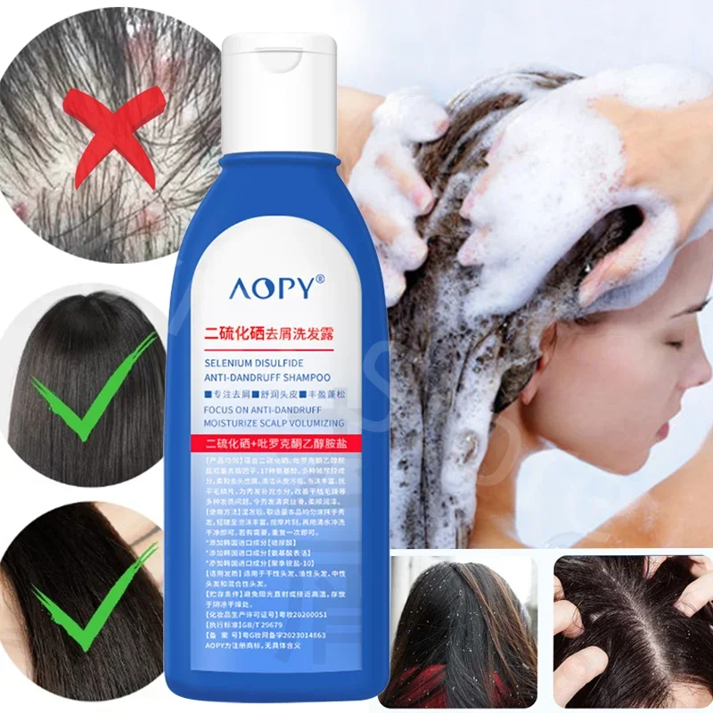 Get Rid of Dandruff Selenium Disulfide Shampoo Oil Control Refreshing Anti-itch Anti-dandruff Shampoo Nourishing Soft Shampoo