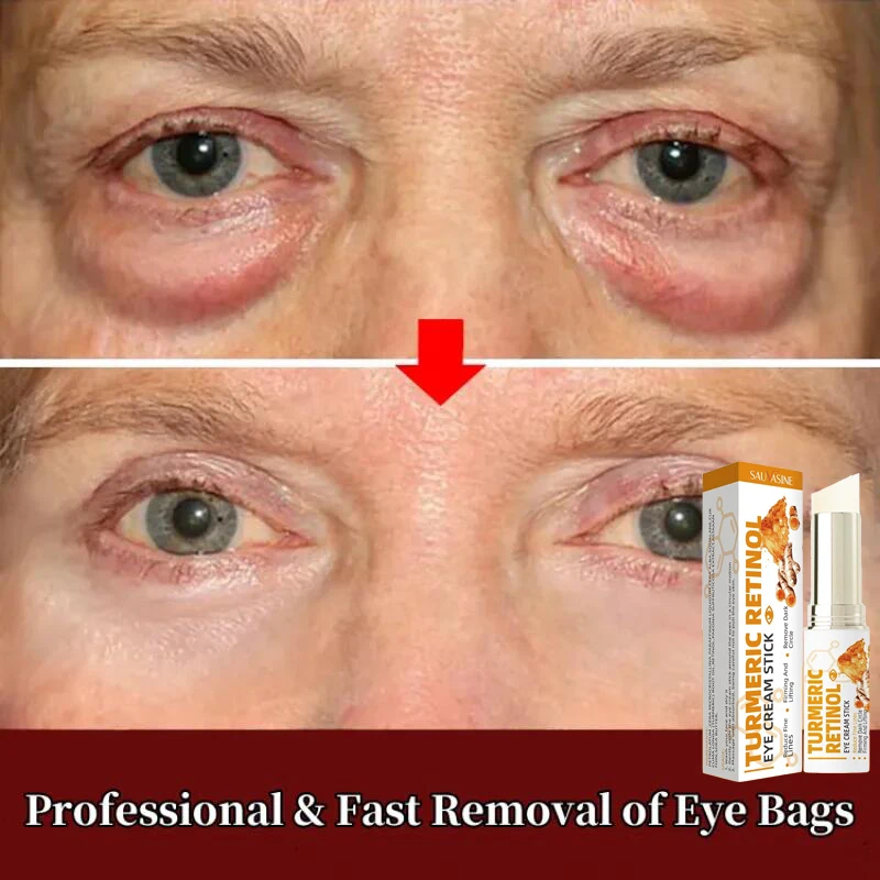 

Retinol Anti-Wrinkle Eye Cream Remove Eye Bags Dark Circles Lifting Firming Fade Fine Lines Anti-Puffiness Repair Eye Care Stick